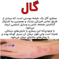 کرم ویتامین e و الوعه ورا برند ویتابلا